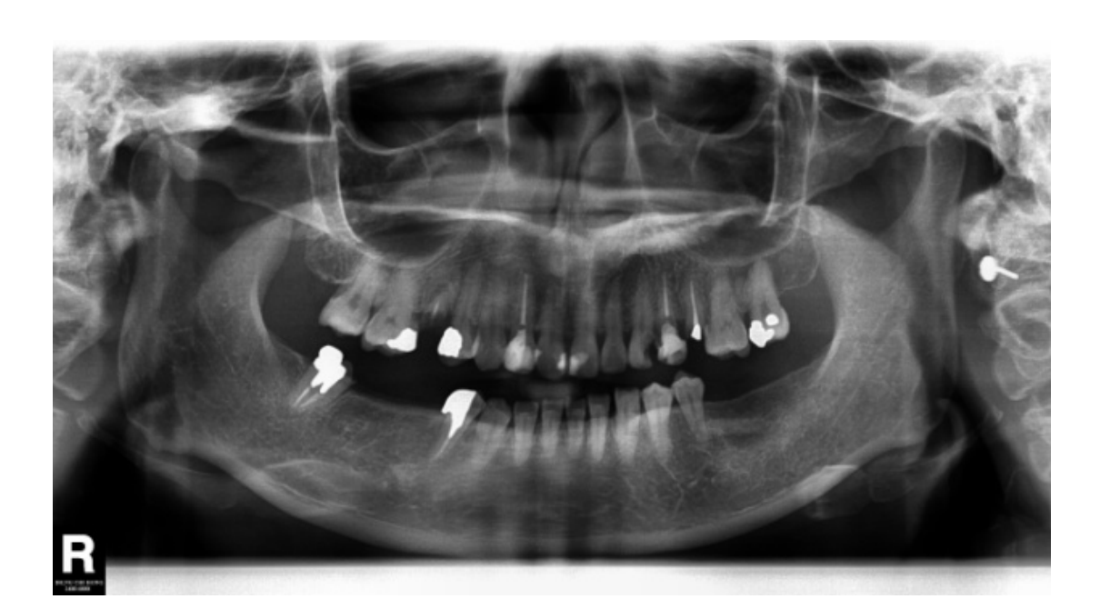Decoding the DCHK HKDLE Part 3 Exam: Clinical Reasoning & Sample Case Analysis